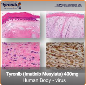 imatinib mesylate - Leukaemia and soft tissue sarcoma